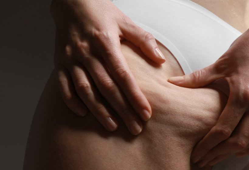 Apa benar Lymphatic Drainage Massage dapat mengurangi selulit?